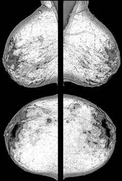 B_3020_1 Processed B_3020_1 Processed
